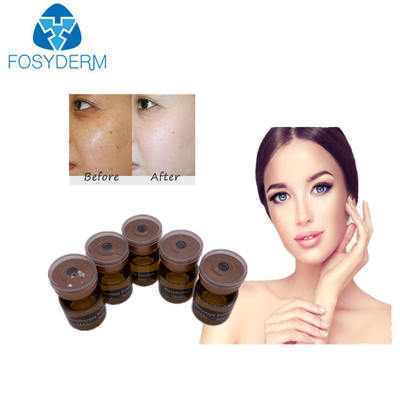 het Serum die van 20mg/ml 5ml Mesotherapy Meso Oplossing witten