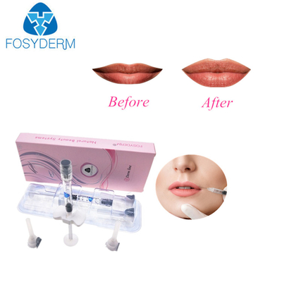 2ml huid Dwars Verbonden Hyaluronic Pen Fillers