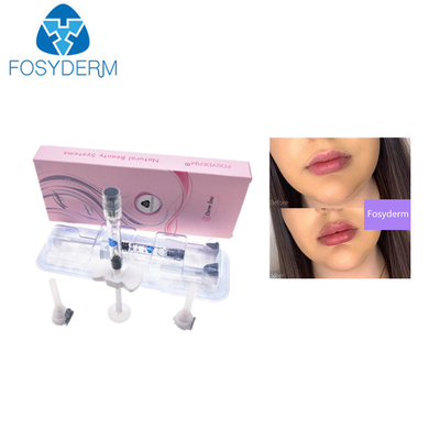 0.28mm Ha de Huidinjectie van de Vullers Hyaluronic Zure 1ml Lip
