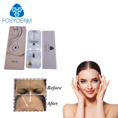 De gezichts Hyaluronic Zure Huidinjectie van de Versterkersha van de Vullerlip