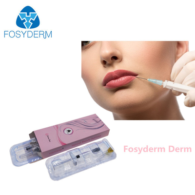 van de de Lippen Huidvuller van 1ml 2ml de Injecteerbare Dwars Verbonden Injectie van de de Rimpelverwijdering