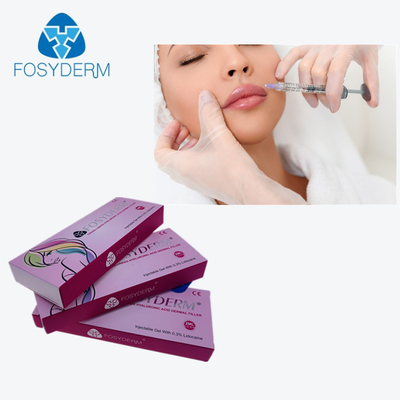 Langs in spuit de kruis Verbonden Huidvuller 2Ml Derm van Ha om Lippenverhoging te bereiken