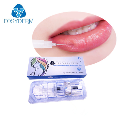 2ml de injecteerbare Injectie van de de Aaneenschakelings Hyaluronic Zure Vuller van BDDE Dwars voor Lippenvolume