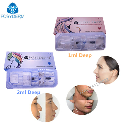 Het kruis verbond Injecteerbare Hyaluronic Zure Gel Huidvuller 1ml 2ml voor Lippen Gezichtshuid