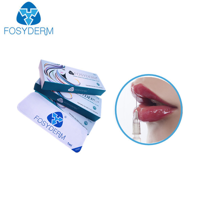 Verhoging van 1,1 Hyaluronic Zure de Vullerslippen van Ml Derm 24 Mg met Lidocaine