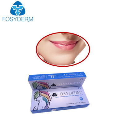 Van het de Vullervolume van glimlachlijnen Hyaluronic Zure Huidlidocaine van de Lijnlyft van Derm Huidvullers