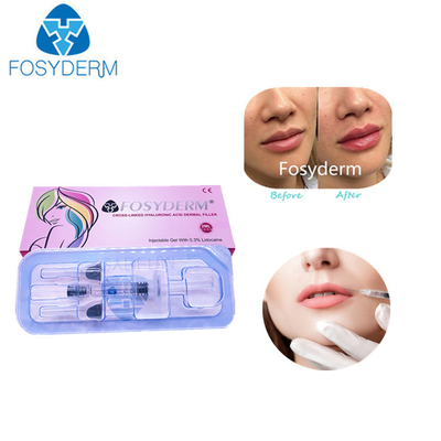 2 van de de Vullerlip van ml Zure Hyaluronic Dwars Verbonden Huid de Vullerinjecties