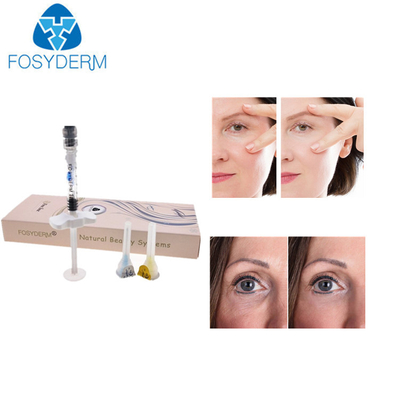 Van de Vuller Gezichtsrimpels van de oogrimpel Hyaluronic Zure Huid de Injectievuller