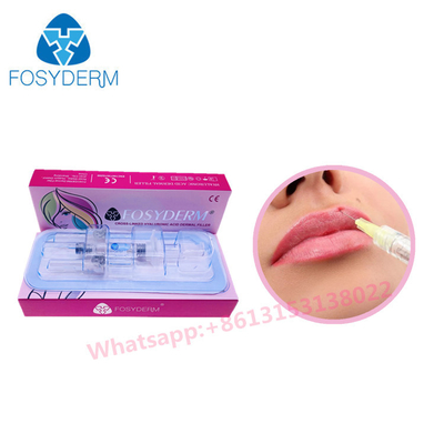 Vullers van de Vullerkruis Verbonden Ha van de Fosyderm Hyaluronic Zure niet Invasieve Lip