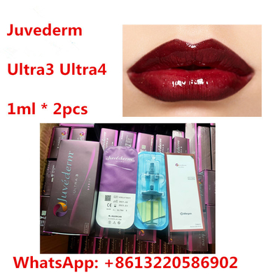 De Huidvuller van Ha van de Juvedermlip met Lidocaine Ultra3 Ultra4