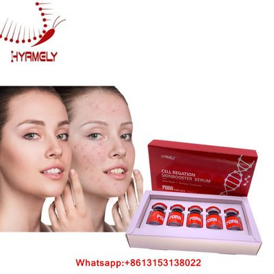 PDRN-Serum voor de Gezichtsinjectie Mesotherapy van Hyamely van de Huidregeneratie