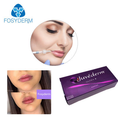 Van het Geljuvederm van de Ultra3ultra4 Voluma Hyaluronic Zure Huidvuller de Lippenvuller 24mg/Ml