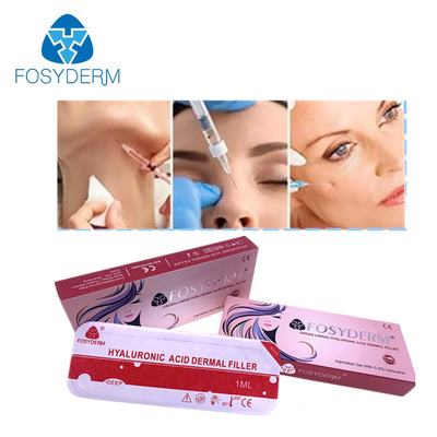 De lip vult Wang die de Gezichts Huidvuller Injecteerbare Fosyderm 2ml opheft van Ha