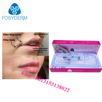 Hyaluronzuur Ha Injecties 1 ml 2 ml 5 ml